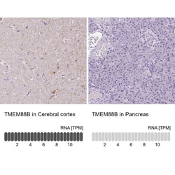 TMEM88B Antibody, Novus Biologicals 25 &mu;L, Unlabeled:Antibodies, Polyclonal